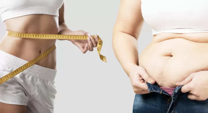 Liposuction (Yağ Aldırma)